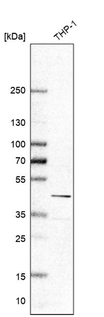 Galectin 9 Antibody in Western Blot (WB)