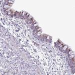 FAM108A1 Antibody in Immunohistochemistry (Paraffin) (IHC (P))