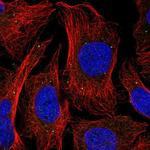 FAM108A1 Polyclonal Antibody