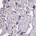 NAPSA Antibody in Immunohistochemistry (IHC)