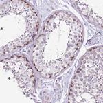 MRPL36 Antibody in Immunohistochemistry (Paraffin) (IHC (P))