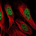 PPP1R10 Polyclonal Antibody