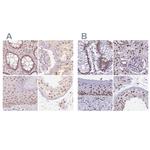 PPP1R10 Antibody in Immunohistochemistry (IHC)