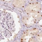 PPP1R10 Antibody in Immunohistochemistry (IHC)