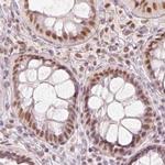 PPP1R10 Antibody in Immunohistochemistry (IHC)