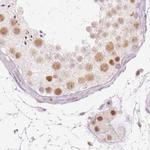 PPP1R10 Antibody in Immunohistochemistry (IHC)
