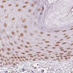 PPP1R10 Antibody in Immunohistochemistry (IHC)