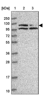 PPP1R10 Antibody in Western Blot (WB)