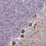 SUCO Antibody in Immunohistochemistry (Paraffin) (IHC (P))
