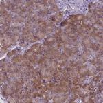 SUCO Antibody in Immunohistochemistry (Paraffin) (IHC (P))