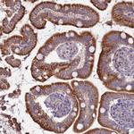 SUCO Antibody in Immunohistochemistry (Paraffin) (IHC (P))
