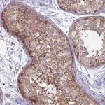 SUCO Antibody in Immunohistochemistry (Paraffin) (IHC (P))
