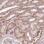 RPL21 Antibody in Immunohistochemistry (Paraffin) (IHC (P))