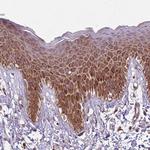 RPL21 Antibody in Immunohistochemistry (Paraffin) (IHC (P))