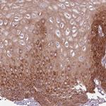 RPL21 Antibody in Immunohistochemistry (IHC)