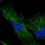 TMEM200C Antibody in Immunocytochemistry (ICC/IF)