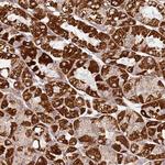 TMEM200C Antibody in Immunohistochemistry (Paraffin) (IHC (P))