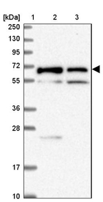 TMEM200C Antibody in Western Blot (WB)