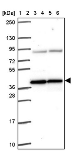 PIH1D1 Antibody in Western Blot (WB)