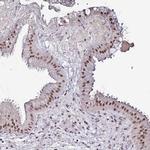 PSMA7 Antibody in Immunohistochemistry (IHC)
