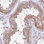 DCAF4 Antibody in Immunohistochemistry (Paraffin) (IHC (P))