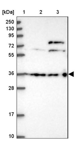 DCAF4 Antibody in Western Blot (WB)