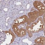 OR7C2 Polyclonal Antibody