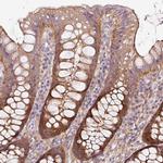 SOS2 Polyclonal Antibody