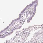 PDXDC1 Antibody in Immunohistochemistry (Paraffin) (IHC (P))