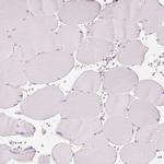 PDXDC1 Antibody in Immunohistochemistry (Paraffin) (IHC (P))