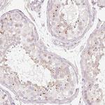 PDXDC1 Antibody in Immunohistochemistry (IHC)