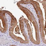 HGD Antibody in Immunohistochemistry (Paraffin) (IHC (P))