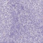 HGD Polyclonal Antibody