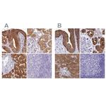 HGD Antibody in Immunohistochemistry (IHC)
