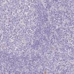 HGD Antibody in Immunohistochemistry (IHC)