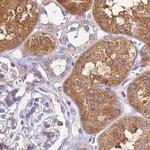 HGD Antibody in Immunohistochemistry (IHC)
