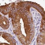 HGD Antibody in Immunohistochemistry (IHC)