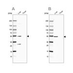 HGD Antibody in Western Blot (WB)