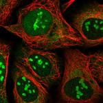 SS18L2 Polyclonal Antibody