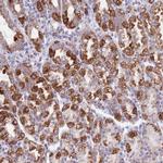 SS18L2 Antibody in Immunohistochemistry (Paraffin) (IHC (P))