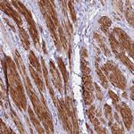 KBTBD3 Polyclonal Antibody