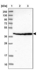 SCARA3 Antibody in Western Blot (WB)