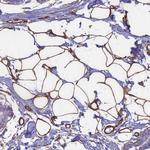 EHD2 Antibody in Immunohistochemistry (Paraffin) (IHC (P))
