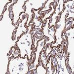 EHD2 Antibody in Immunohistochemistry (Paraffin) (IHC (P))