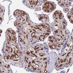 EHD2 Antibody in Immunohistochemistry (Paraffin) (IHC (P))