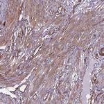 EHD2 Antibody in Immunohistochemistry (Paraffin) (IHC (P))