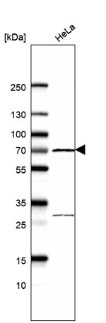 EHD2 Antibody in Western Blot (WB)