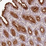 EXD3 Antibody in Immunohistochemistry (Paraffin) (IHC (P))