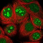 TMA7 Antibody in Immunocytochemistry (ICC/IF)