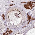 SRRM5 Polyclonal Antibody